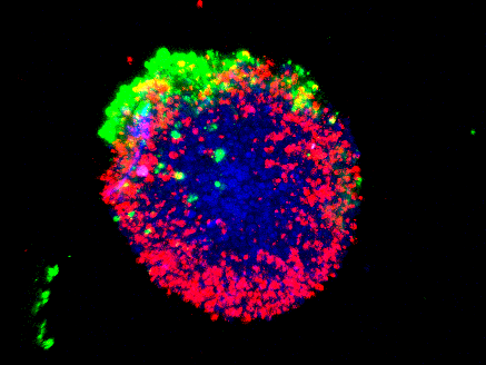 A549 MSC and NK cells spheroid 1 (Snapshot 1) (2)